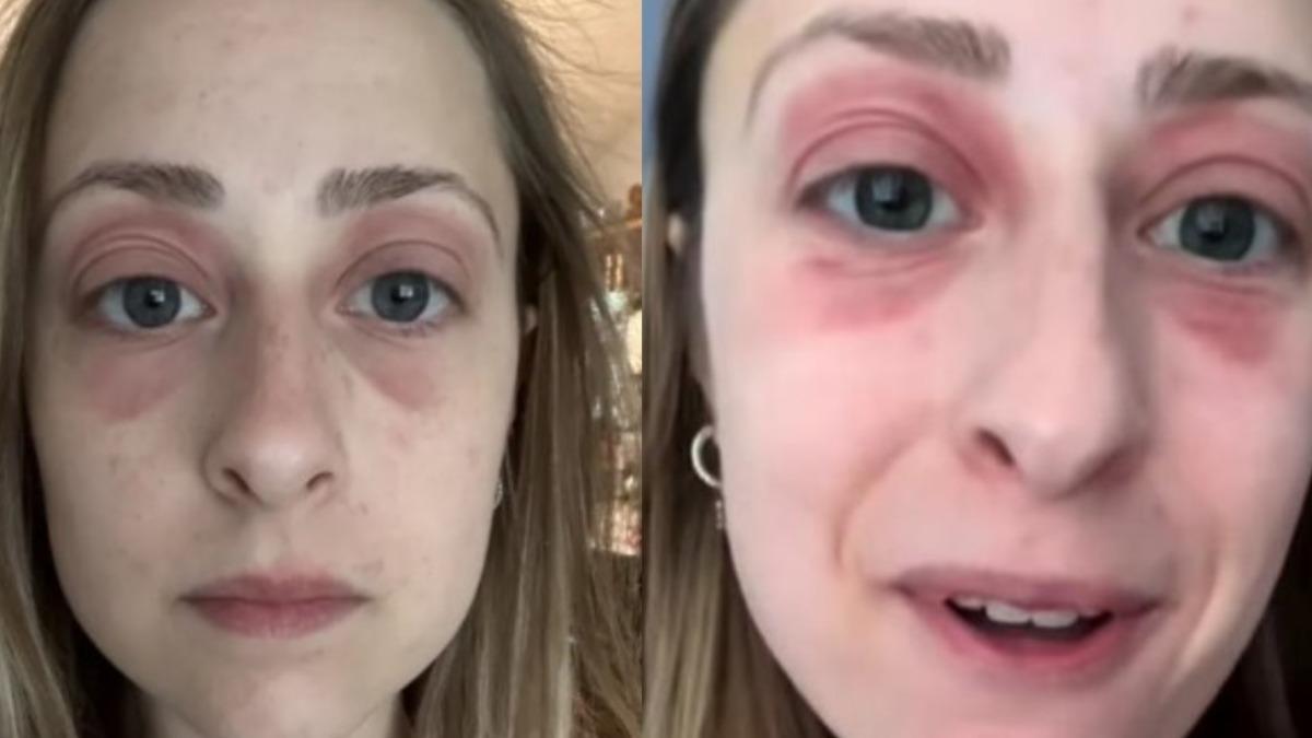 千萬買房變噩夢!美新婚夫妻入住2天就生病 半年整臉爛掉原因曝