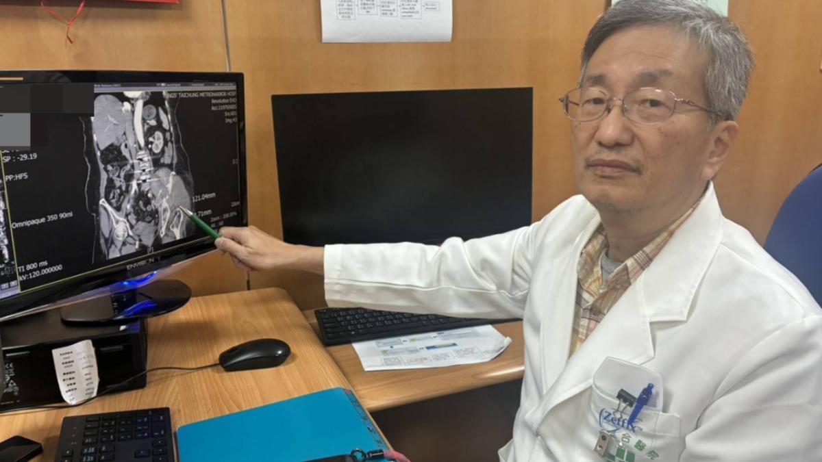 葉啟源說明,銳視刀可以在六秒內擷取錐形束電腦斷層影像,並具有直接在影像上計算劑量的能力。(圖/梧棲童綜合醫院提供)