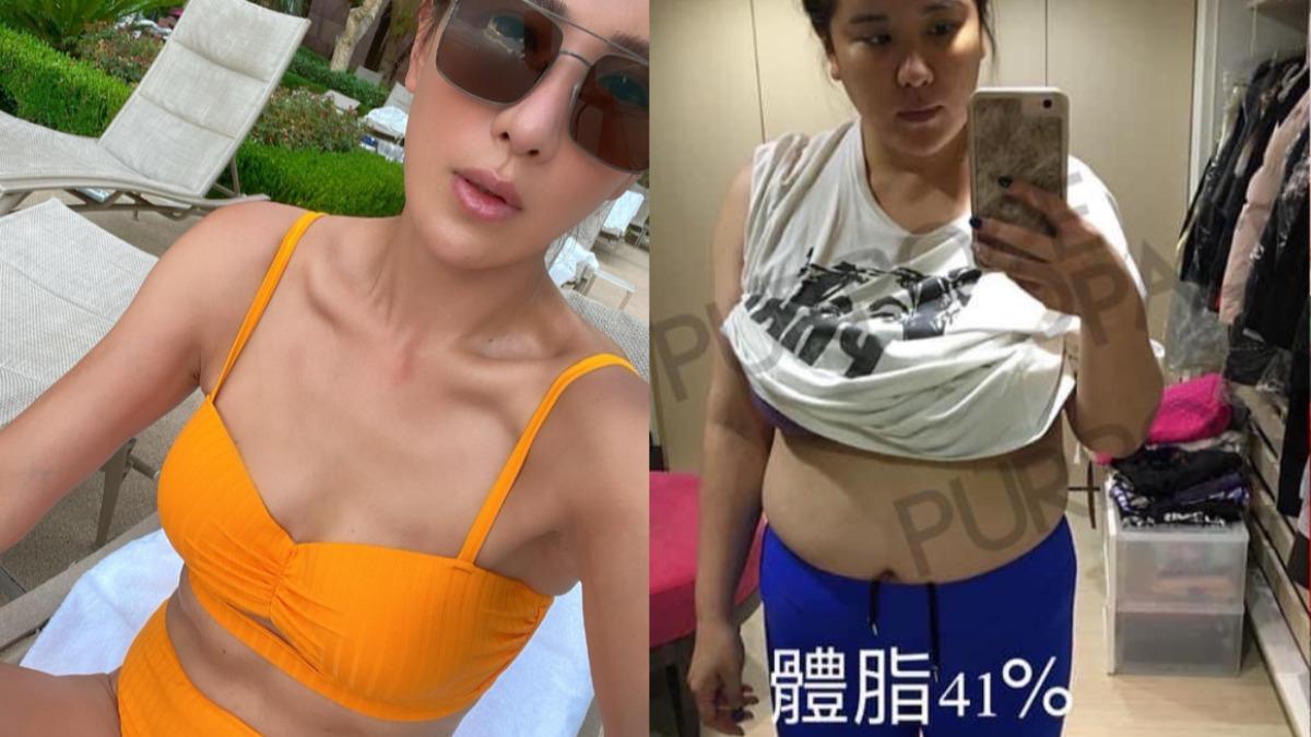 月經亂不只更年期！小禎曾患「這病」暴肥　3招自我檢測法曝