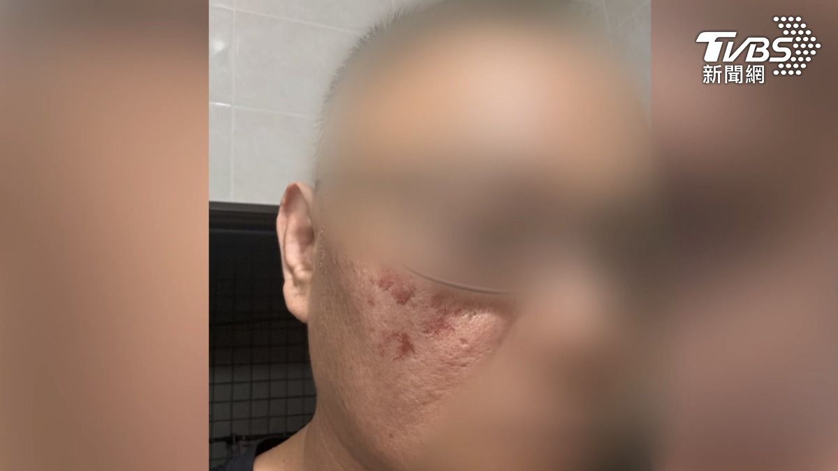 業者控訴,對方拍照後就直接出來要打人,還吐檳榔汁在他臉上。(圖/TVBS)