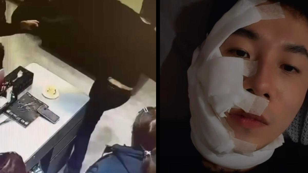 網紅美髮師「一生叔叔」出事！遭客潑辣椒水、毆打　腫臉慘況曝