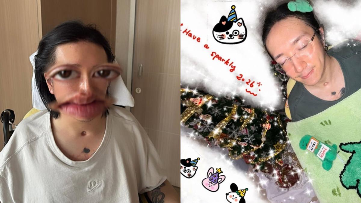 撐不住了！照顧癱瘓兒3年　阿Mo爸驚傳病倒嘆：不知能陪多遠