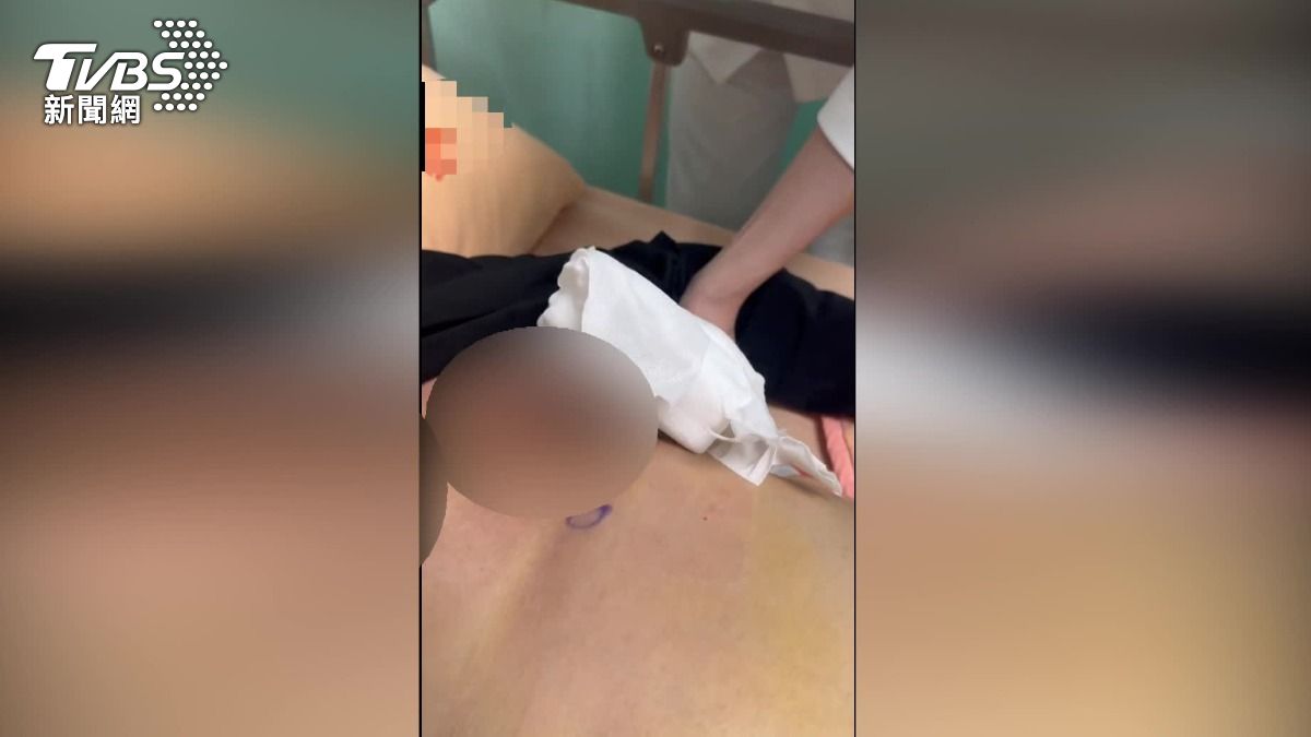 患者提告名醫吳紹琥,指控豐胸手術後害感染,差一點就敗血病。(圖/患者提供)