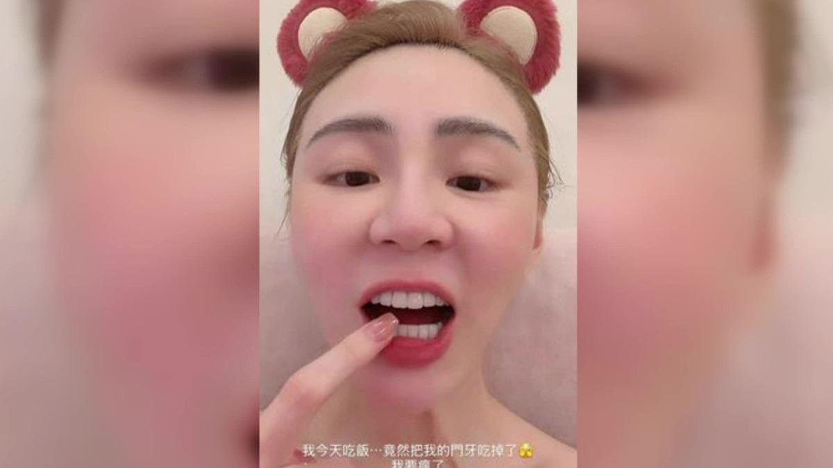 短今吃東西竟然吃到「門牙缺一角」。（圖／翻攝短今IG）
