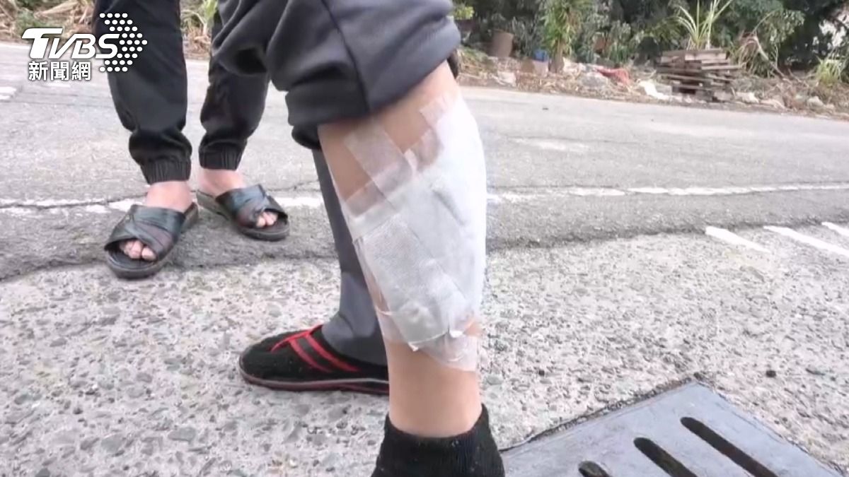 妻車禍住院！8旬翁無力管15犬「放養釀禍」路人遭追咬動保開罰。（圖／TVBS）