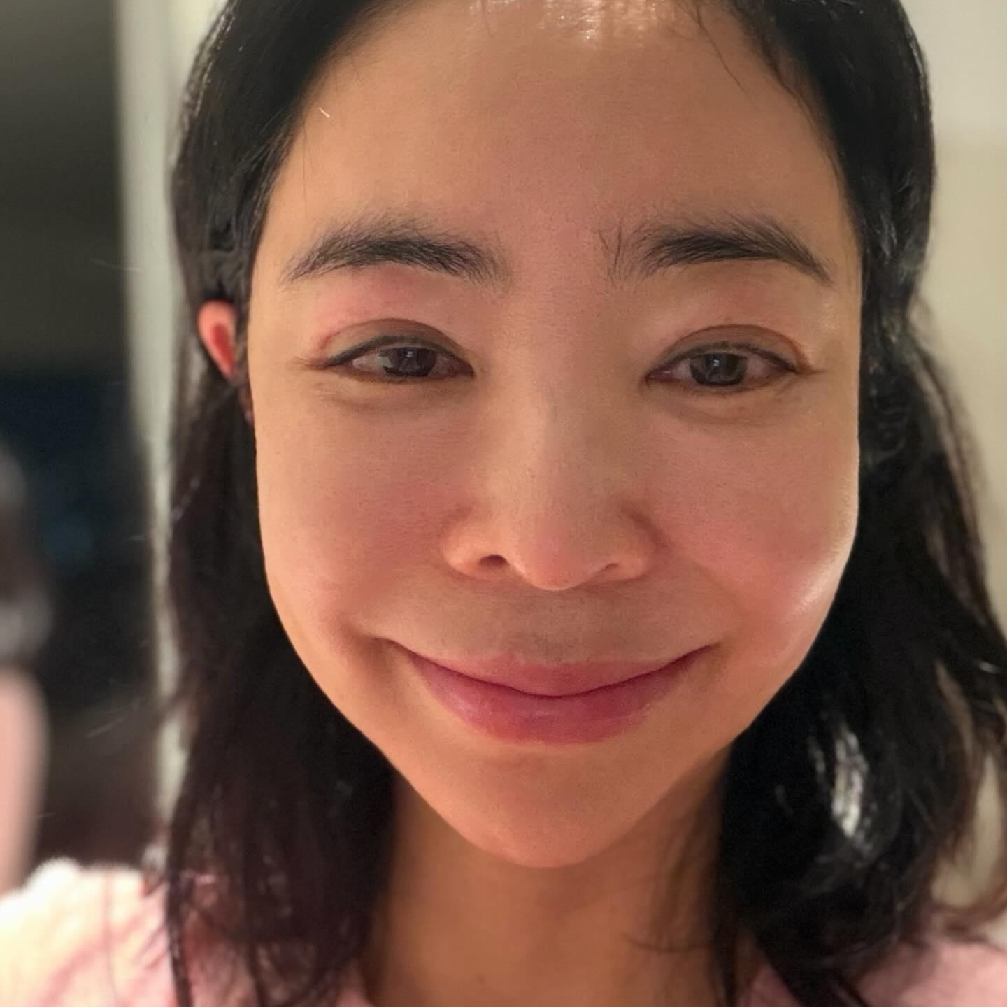 李惠英昨天曬出臉部腫脹照,讓不少粉絲擔憂。(圖/翻攝自李惠英IG)