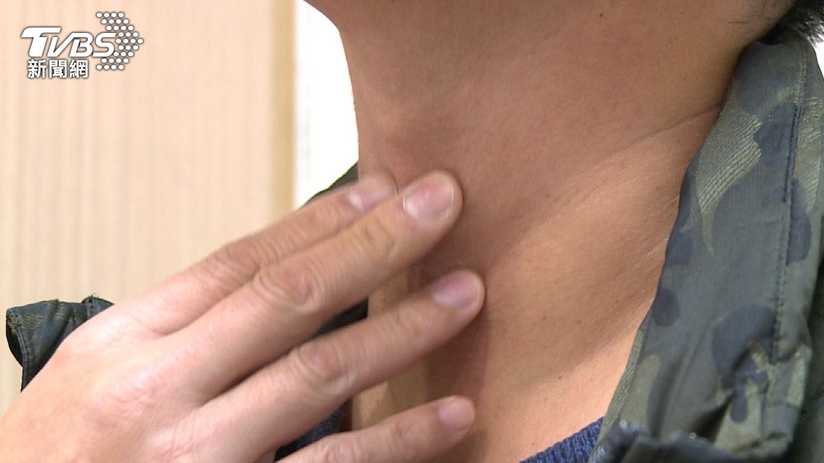 注意!進食常嗆咳.吞嚥退化 恐吸入性肺炎 (圖/TVBS)