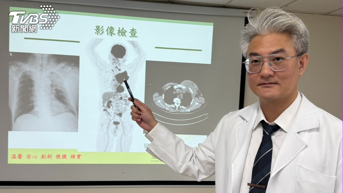 傳產董座淋巴癌長14cm腫瘤！醫警告：再拖1個月恐死亡