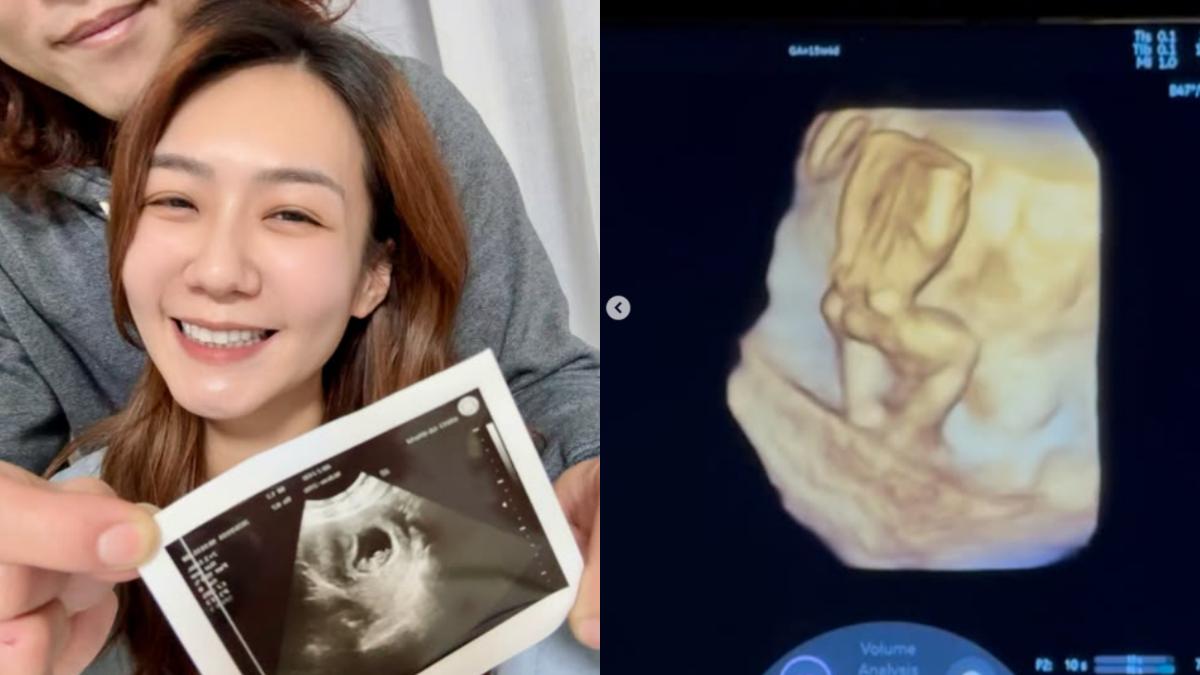 這幕把尪嚇到腿軟　女星懷孕遇到「大魔王」：如何別昏倒