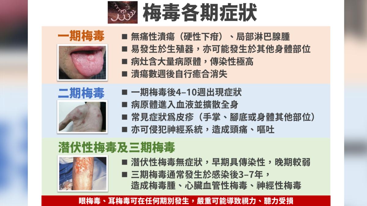 國內梅毒病例升!疾管署點名1族群 感染者增8%