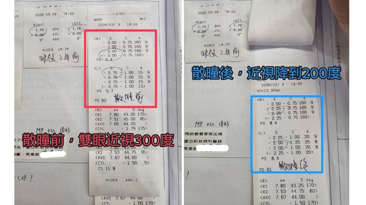 成年人也會有假性近視,因過度用眼,導致眼球內部結構變形。(圖/徐浩恩提供)