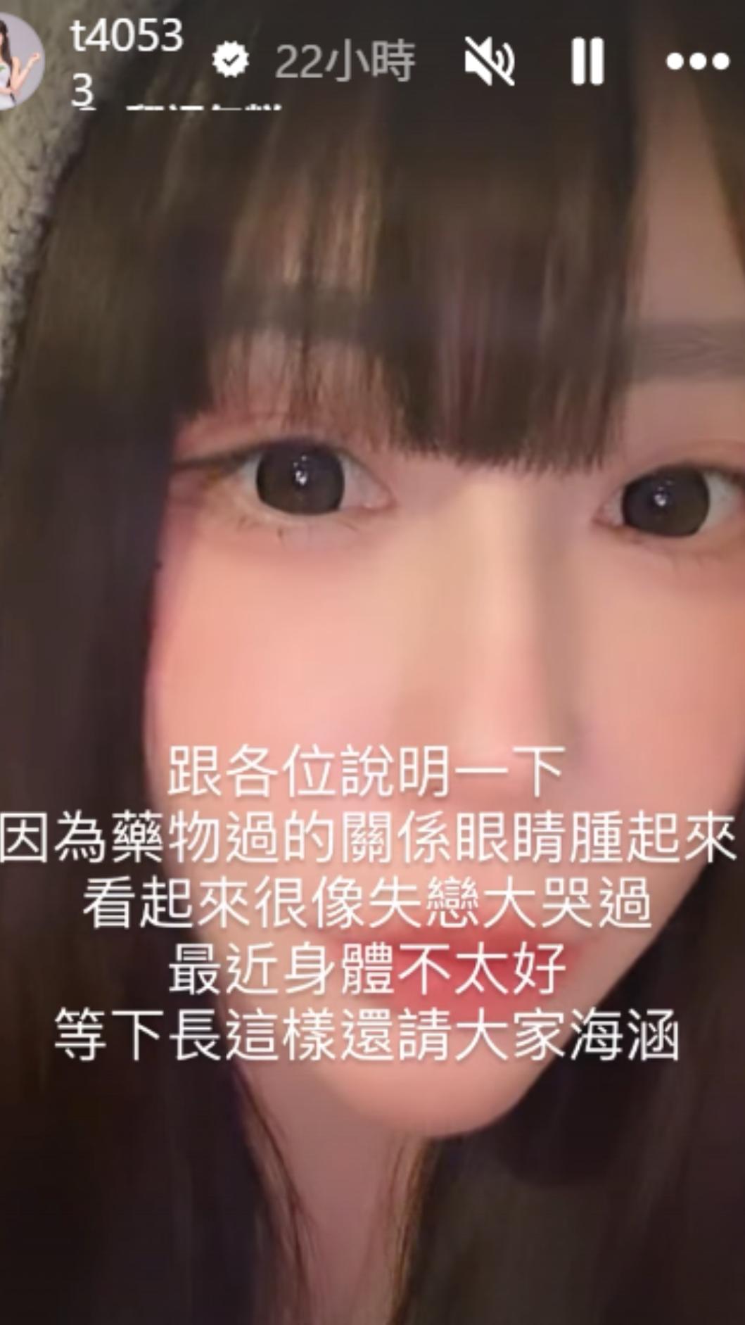 梓梓因藥物過敏眼睛紅腫。(圖/翻攝自梓梓IG)