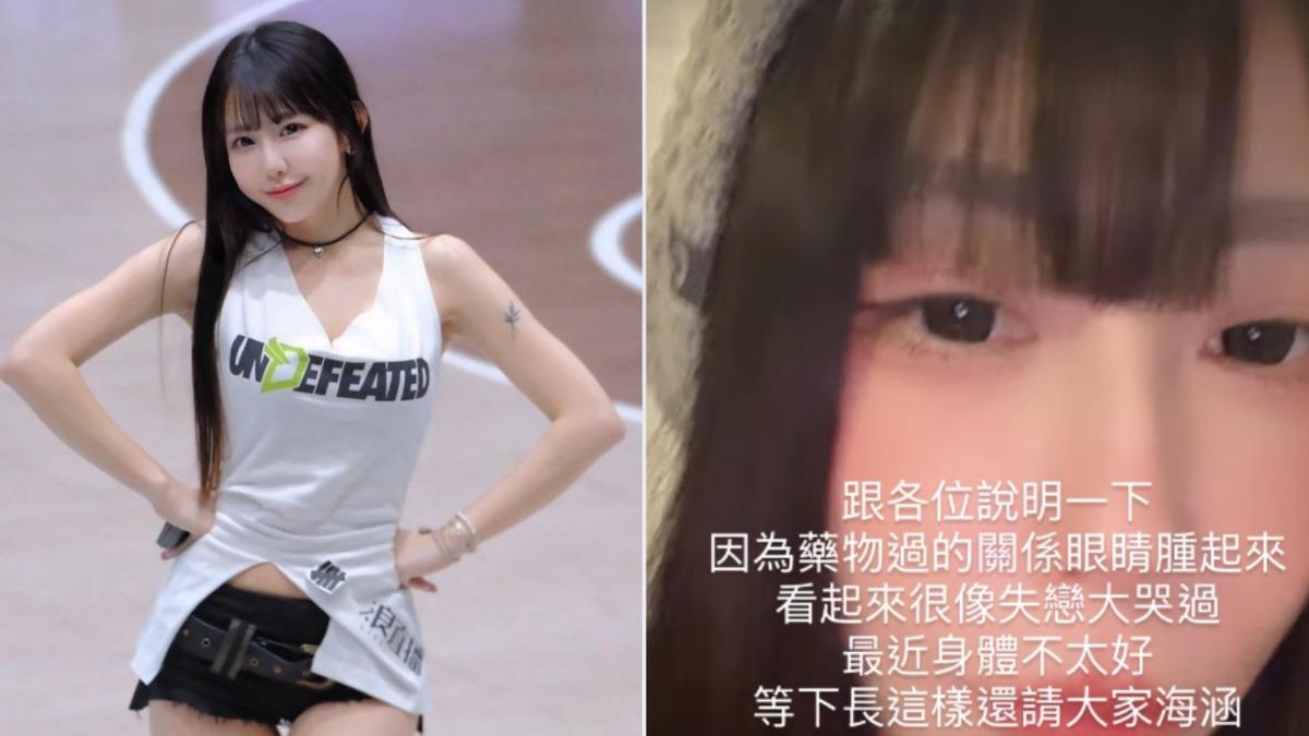 E級啦啦隊女神健康拉警報! 「雙眼腫一圈」曬近距離自拍:像失戀大哭