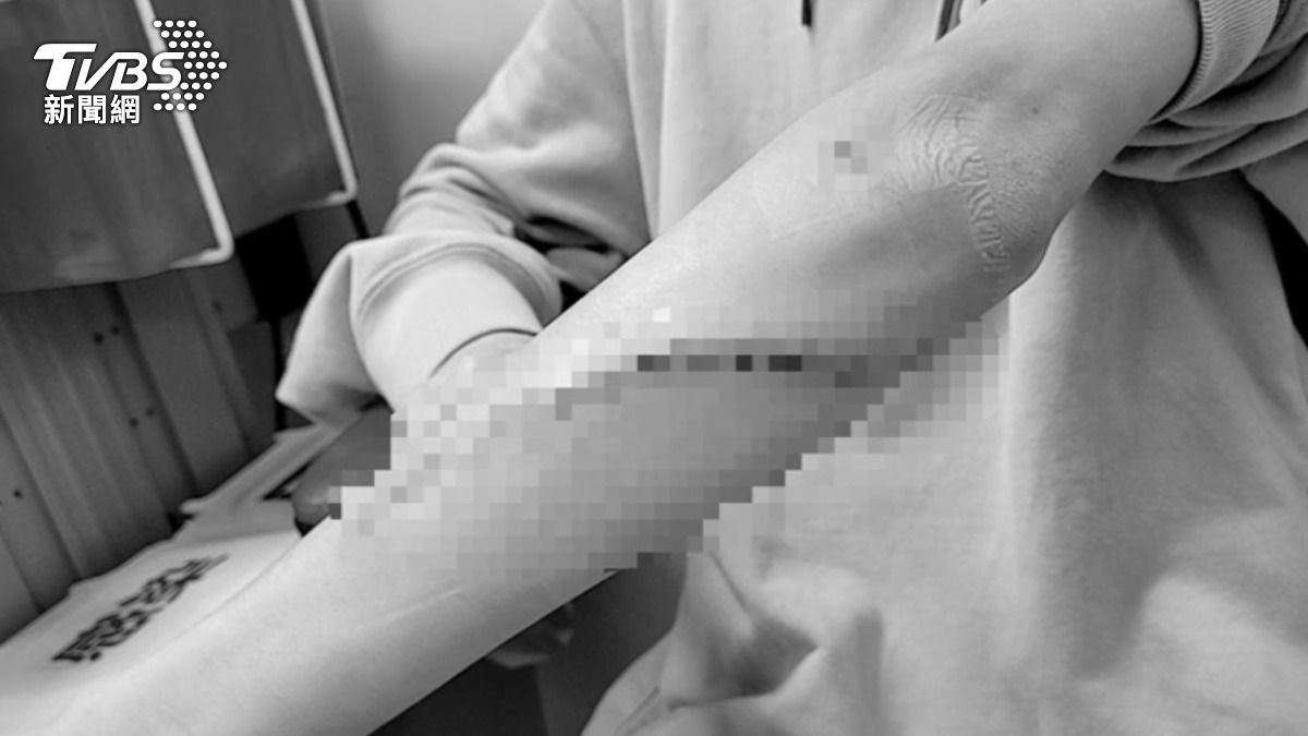 國中生控遭同學過肩摔留13公分傷痕,雙方家長無法達成共識,調解破局。(圖/TVBS)