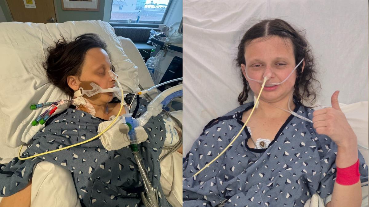 曾2度抗癌成功!美24歲女吃朋友做的菜 染肉毒癱瘓險喪命