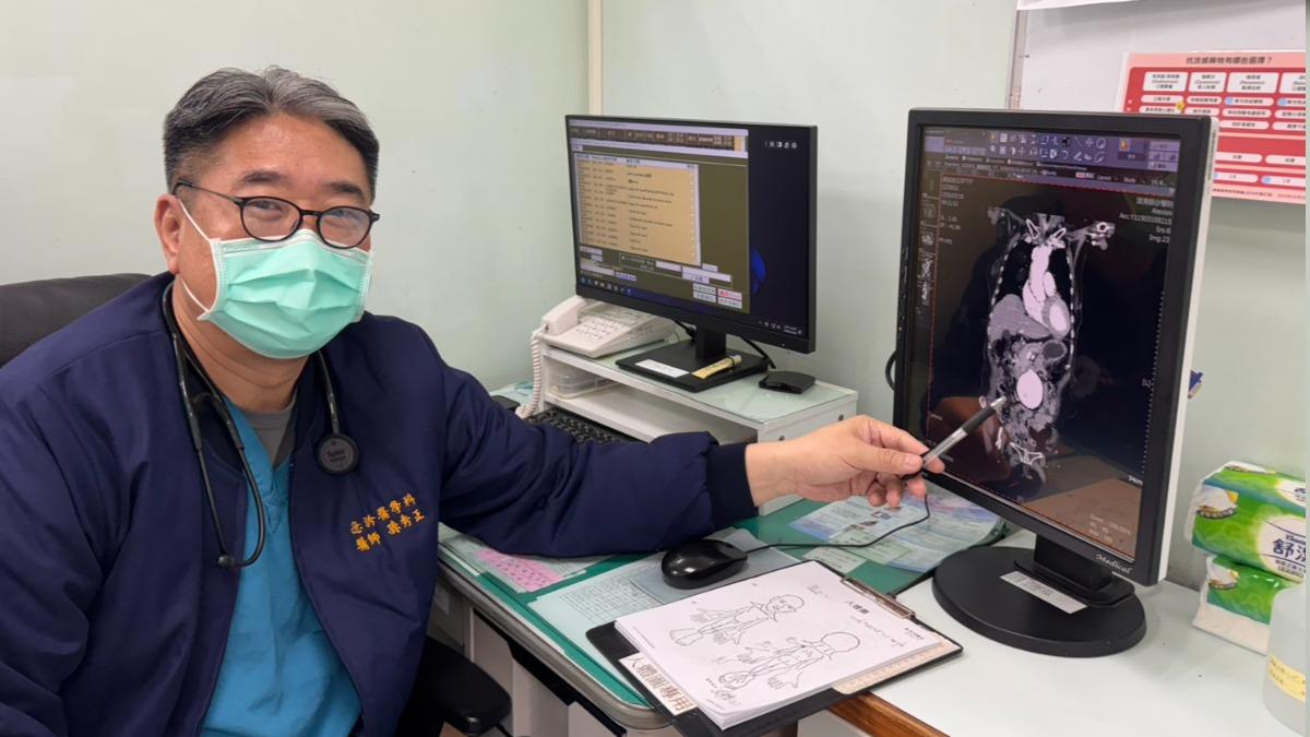 孫秀正指出，腹主動脈瘤是腹部主動脈血管壁，因退化或動脈硬化而逐漸擴張。（圖／澄清醫院平等院區提供）