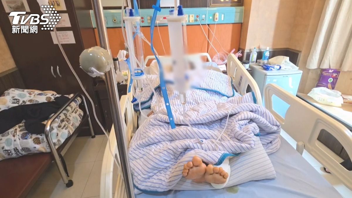 76歲嬤遭3犬圍攻「咬200傷口」 清創3次仍化膿包如木乃伊。(圖/TVBS)