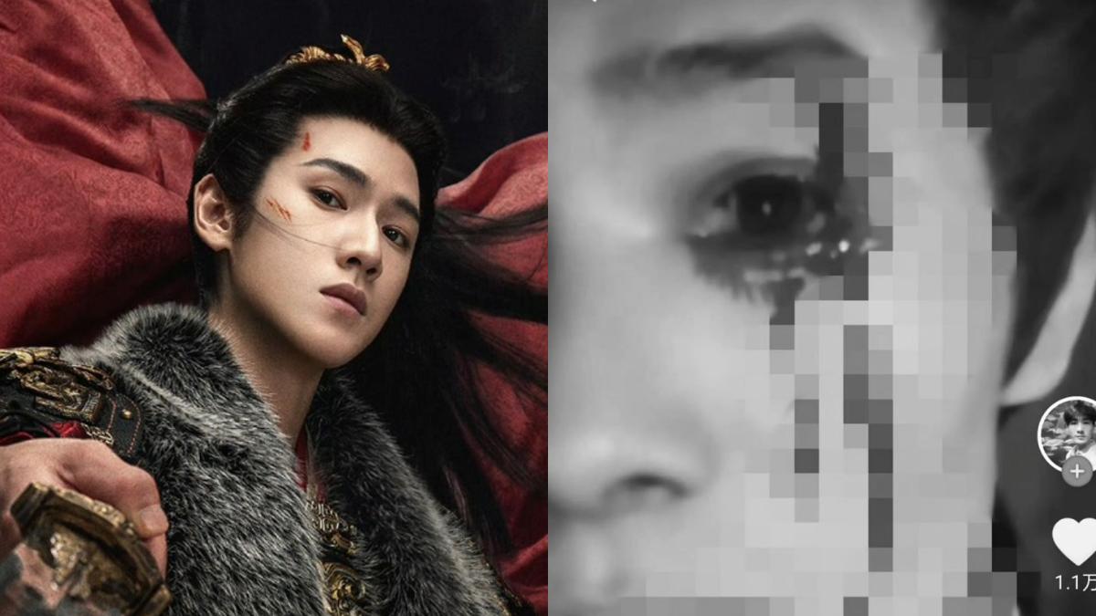李昀銳新戲開拍16天就出事　臨演骨裂「眼珠爆血」控劇組不負責