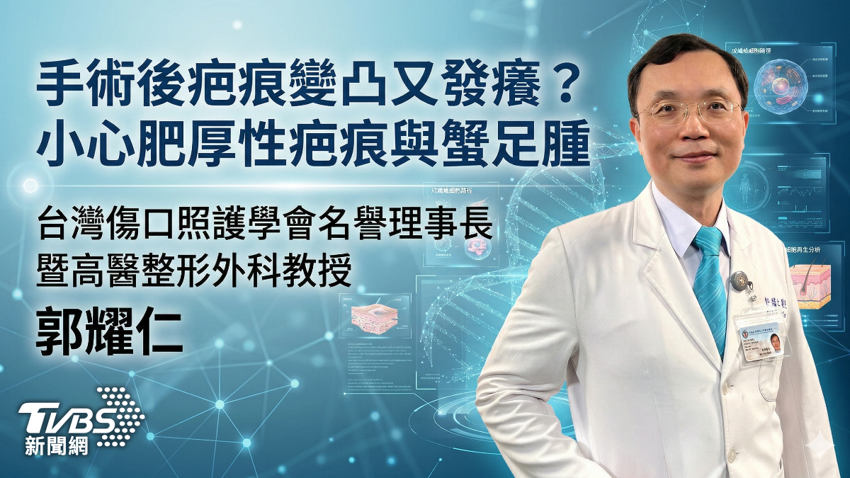 手術後疤痕變凸又發癢?小心肥厚性疤痕與蟹足腫