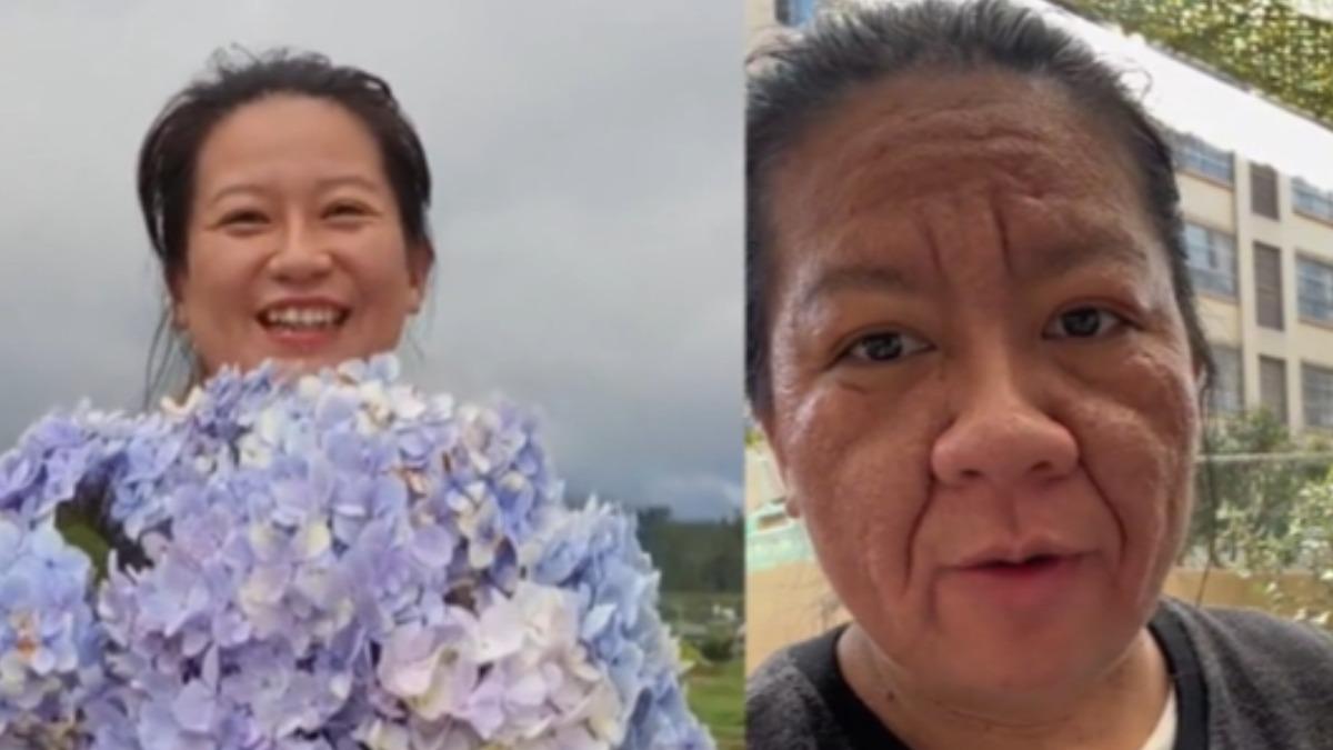 大陸32歲雲南孕婦「阿芹」懷孕後臉部毛孔粗大、膚色黯沉,還長出又深又長的皺紋引發議論。(圖/百度)