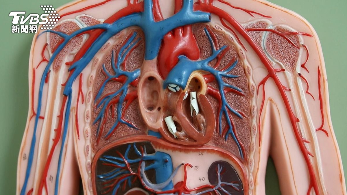 高血脂沒症狀最危險！醫揭「壞膽固醇」堆積機轉 「動脈硬化」恐致心梗中風 (圖/TVBS)
