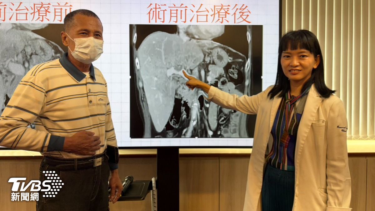 陳怡如與醫療團隊量身打造黃男治療方案。(圖/林冠丞攝)
