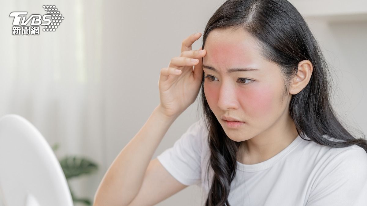 掃墓成紅面關公!敏弱肌恐是「皮膚失火」 護理師授3招自救