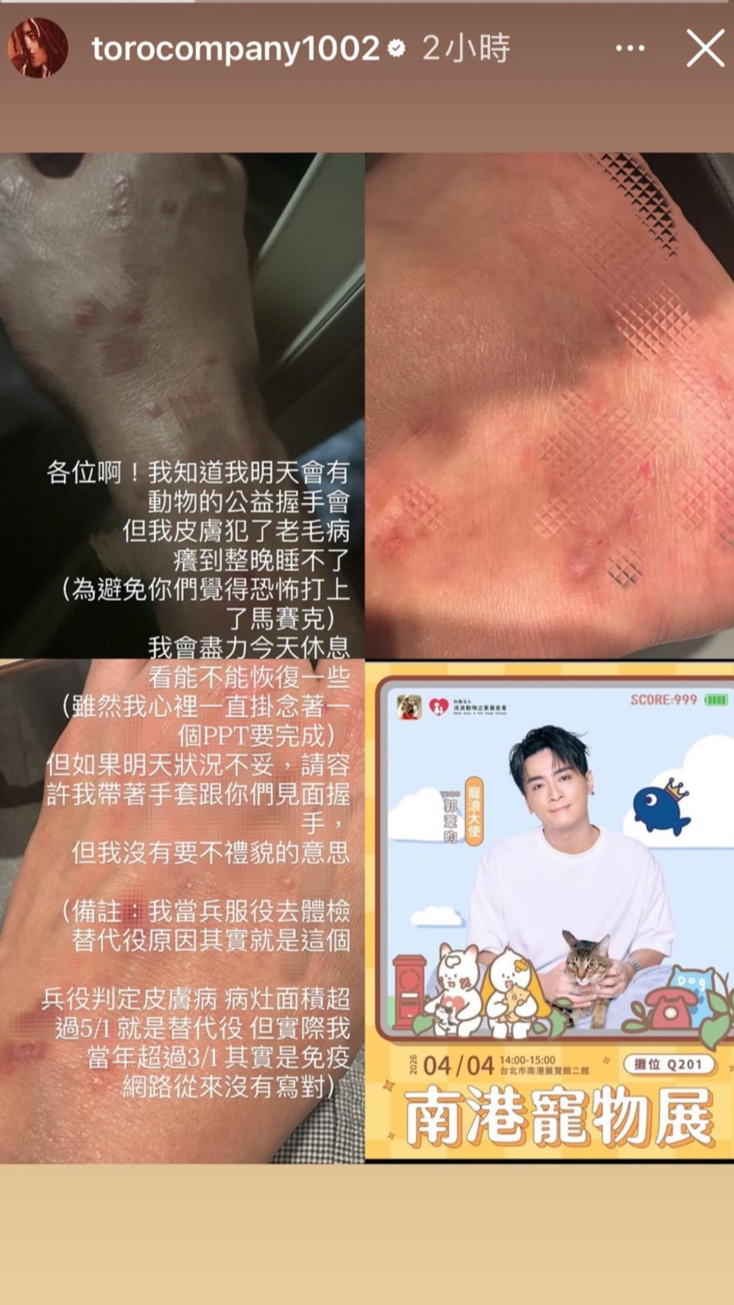 Toro皮膚病發作,更解釋自己當年為何是替代役。(圖/翻攝自Toro IG)