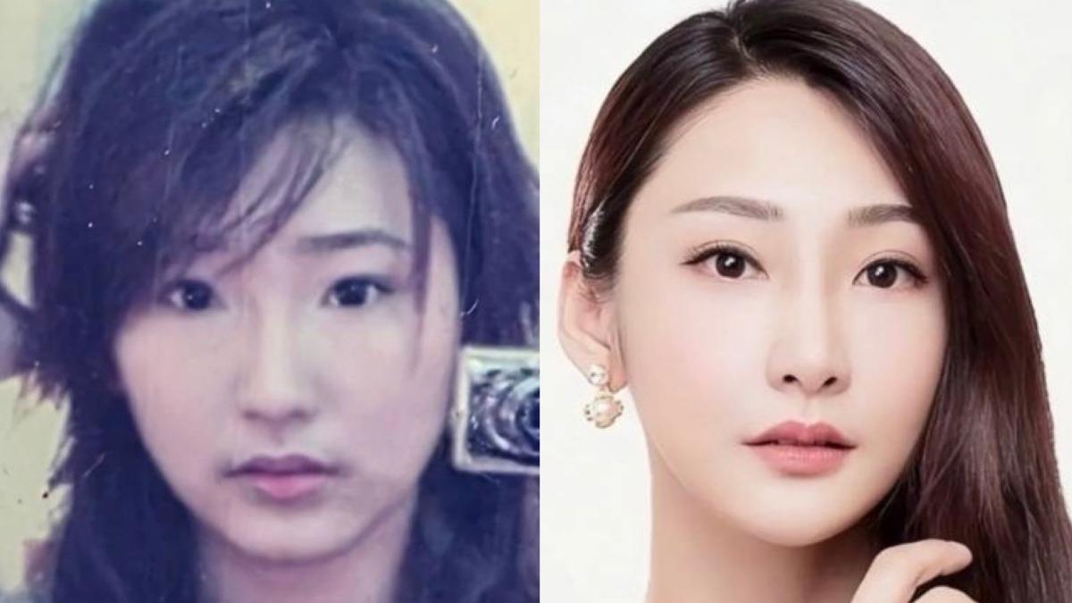 女主持「肝出問題併發肺炎」住院 整型當藝人後悔了!已撐不住「轉行求生」