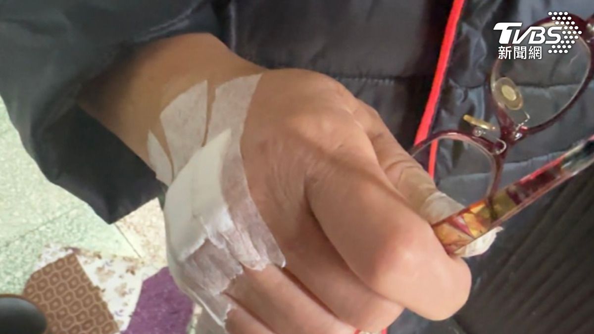一名受傷老婦人餘悸猶存地表示，初次遭遇獼猴便被抓傷，未料隔天出門時，獼猴竟守候在門口「堵人」，造成臉部手部受傷。（圖／TVBS）
