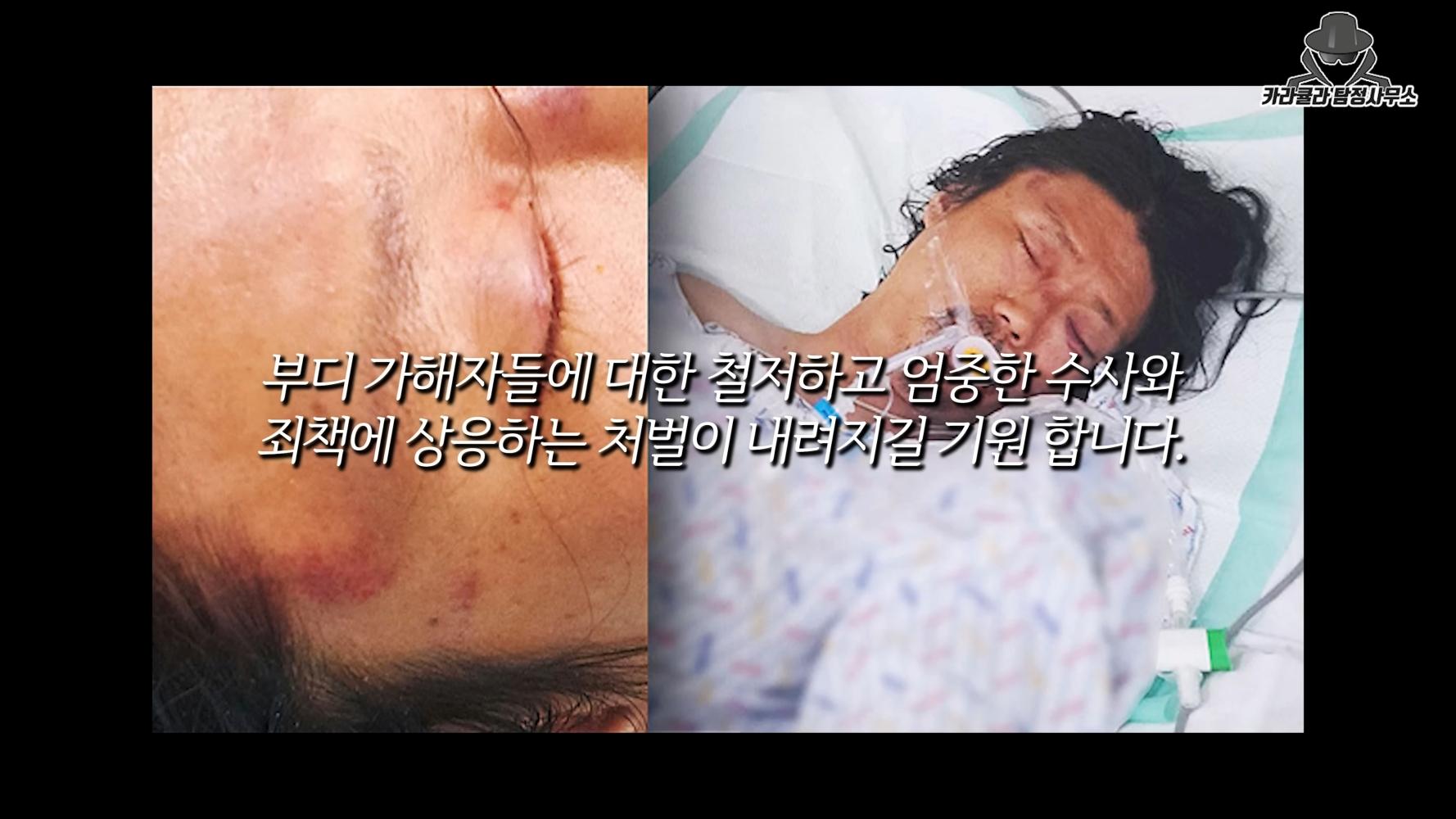 金昌民去年遭圍毆後昏迷,最後被判定腦死。(圖/翻攝自카라큘라 탐정사무소YouTube)
