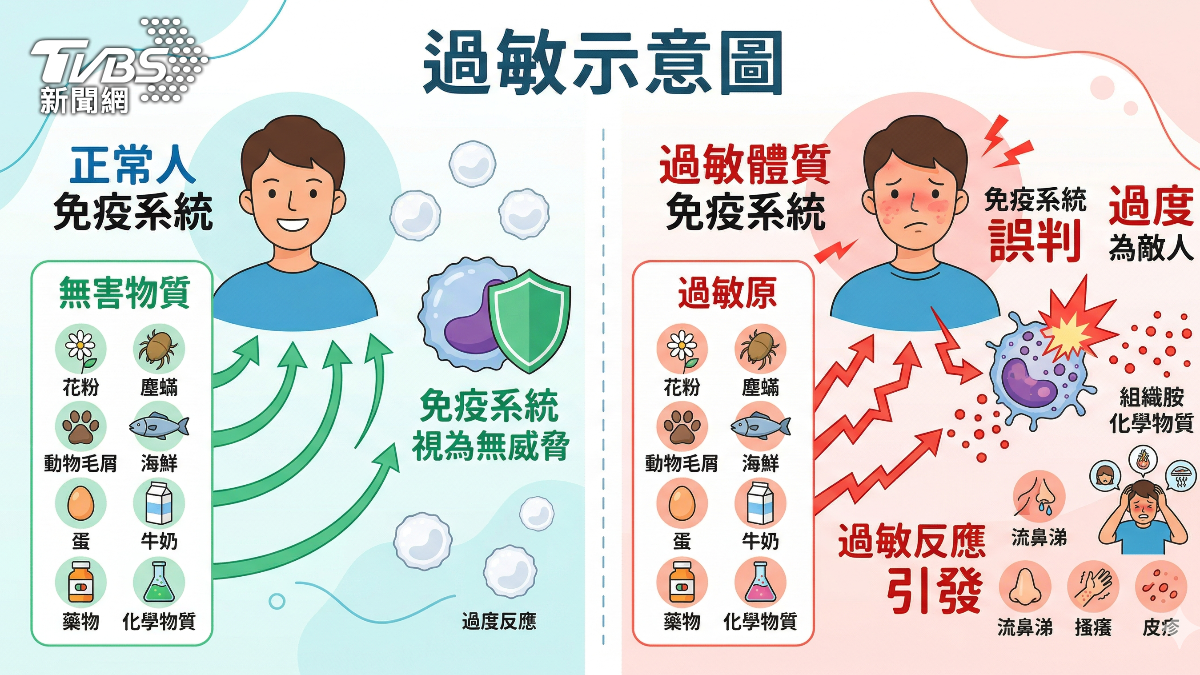春季過敏狂發作不是吃錯食物 醫揭台灣最常見過敏原 竟是... (圖/TVBS)