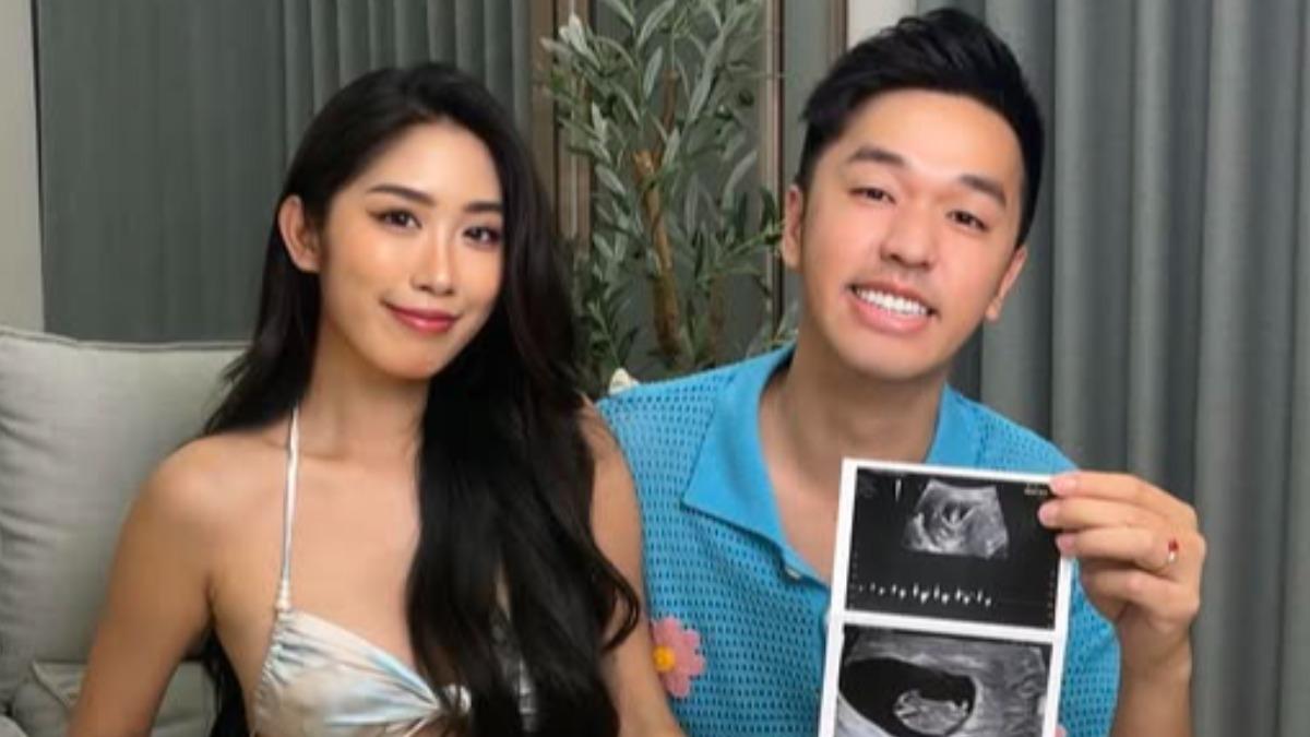 《瘋神》香蕉結婚3年驚喜宣布當爸! 和辣妻曬超音波照:我們的小生命來報到了