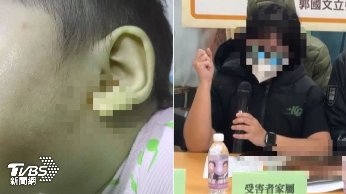 無照虐嬰21次!男嬰「腦出血慘癱」 台南惡保母遭起訴