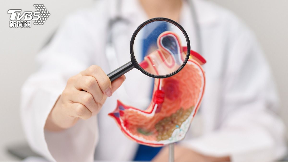 胃鏡見「腸化生」別慌!掌握1關鍵能逆轉 醫:4習慣快改掉
