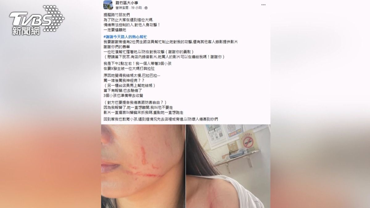 林姓女子則挨了一巴掌，臉部被抓到破相，已前往驗傷並提出告訴。（圖／翻攝路竹區大小事）