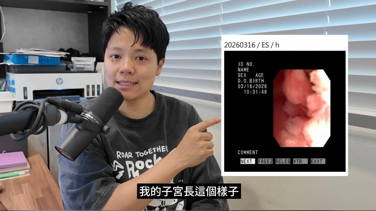 我得了子宮內膜癌前病變!網紅敏迪揭身體早有警訊「非經期出血」