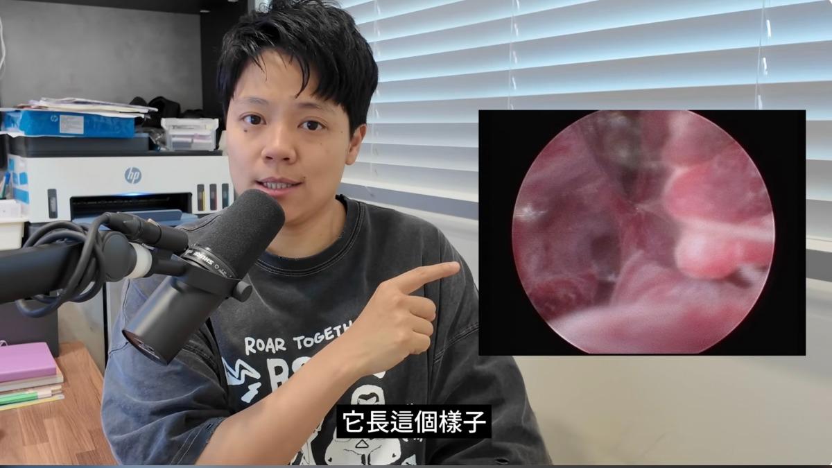 敏迪公布他子宮手術前的樣子。(圖/敏迪選讀YouTube)