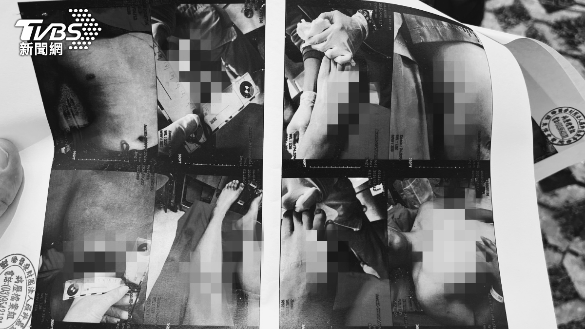 男子全身被毆打致傷,頭部縫了14針。(圖/TVBS)