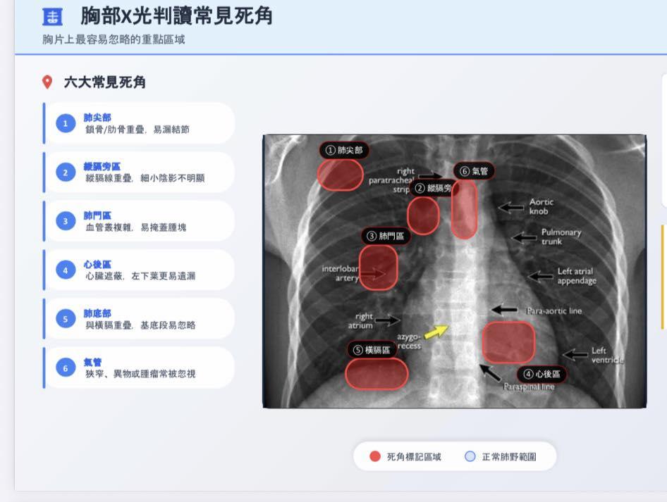 胸部X光判讀常見死角。(圖/翻攝自乳癌權威饒坤銘醫師臉書)