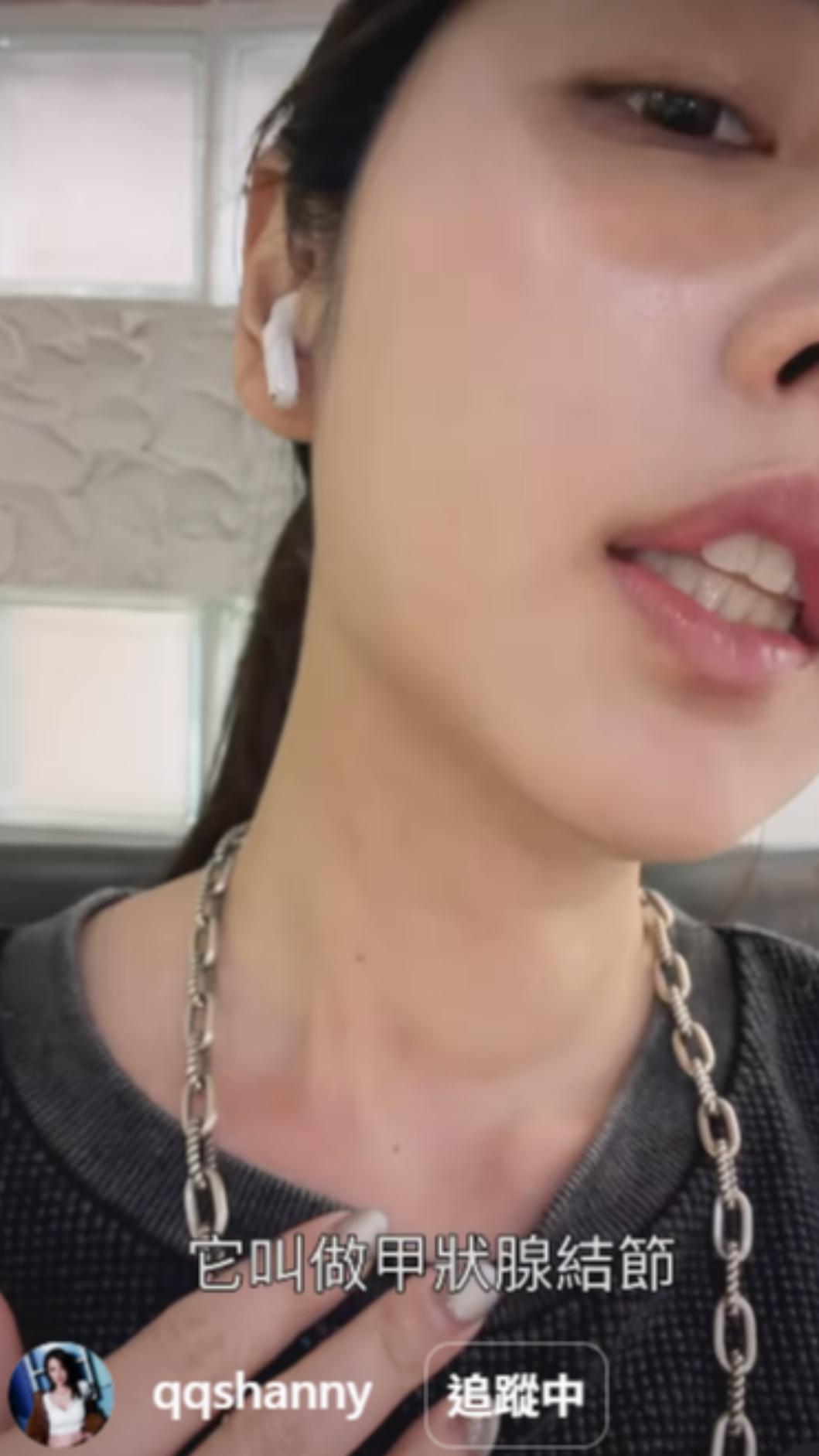 阿諾的甲狀腺結節特別明顯。(圖/翻攝自阿諾IG)
