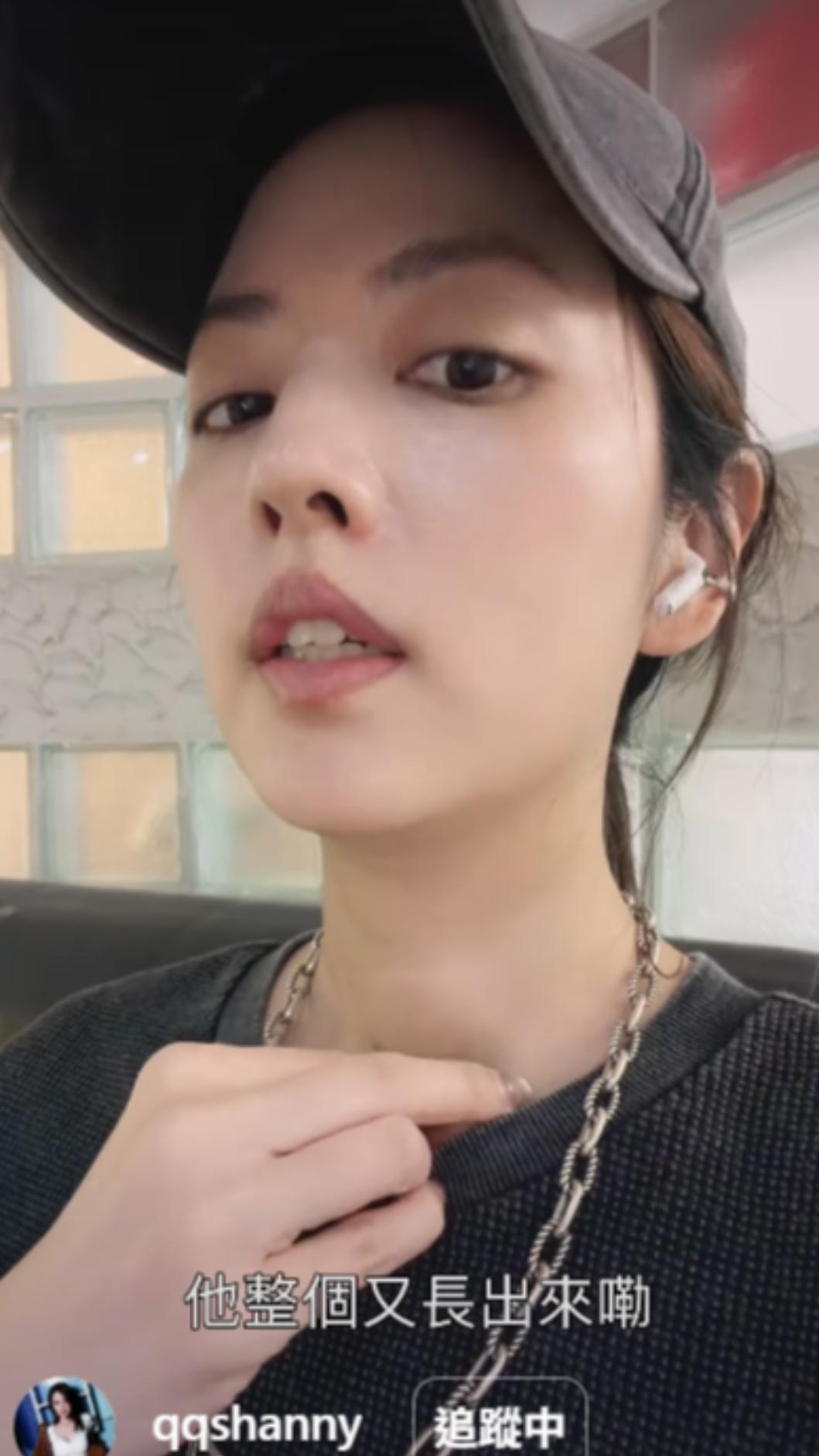 阿諾去做穿刺後三個月又長回來。(圖/翻攝自阿諾IG)