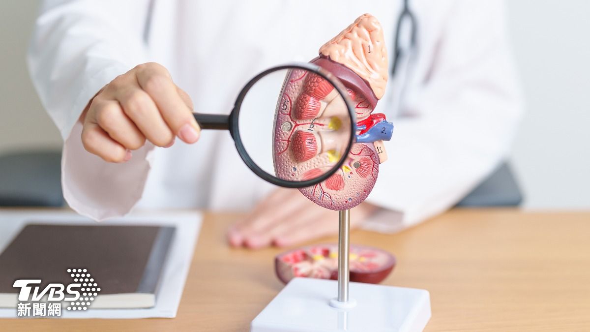 春天回暖「腎結石」飆升！醫揭1習慣最危險：噁心、血尿快就醫