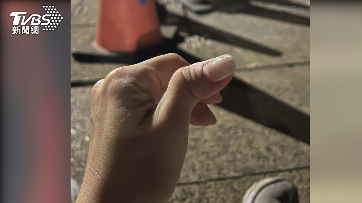 民眾在人行道上跌倒,導致大拇指脫臼。(圖/當事民眾提供)