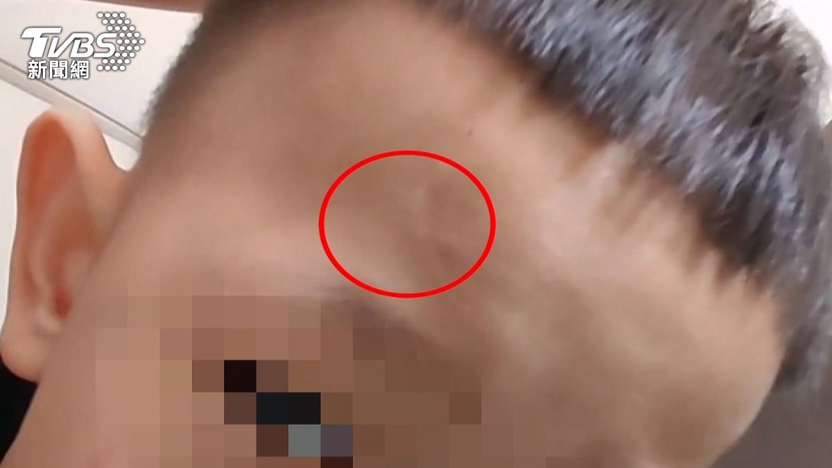男童突然衝上馬路遭撞，母親提告求償２０萬，讓騎士無法接受（圖／TVBS）