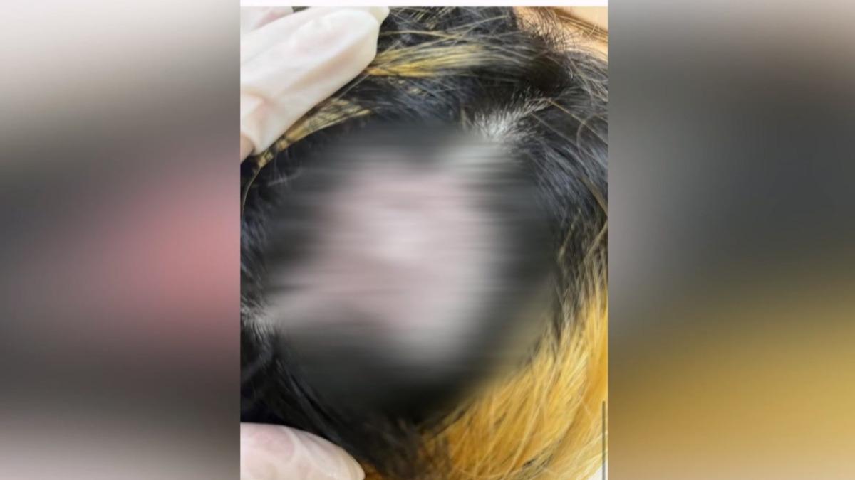 高雄一名女子前往美髮店染髮,期間女子外出用餐一小時,最終導致頭皮灼傷,雙方因此對簿公堂。(圖/翻攝網路)