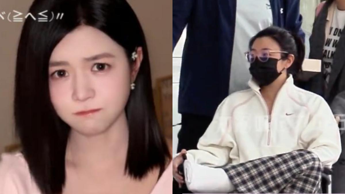 陳妍希弄斷腳筋緊急開刀 「腿傷1個月坐輪椅」停工後現身