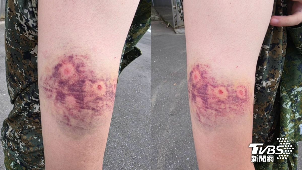 獨/顧立雄震怒沒用?教官持槍「連射」士兵8槍 手臂彈孔傷勢曝光