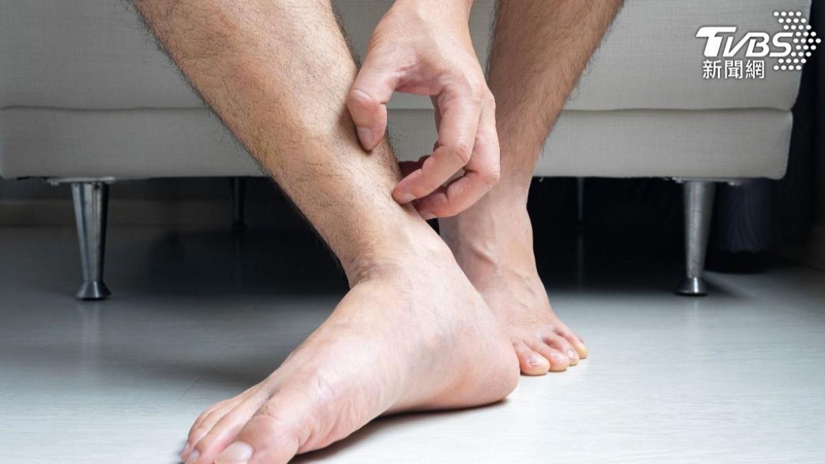 小腿癢狂抓出現密集腫塊!男皮膚變「蛤蟆皮」崩潰求醫:十年沒好
