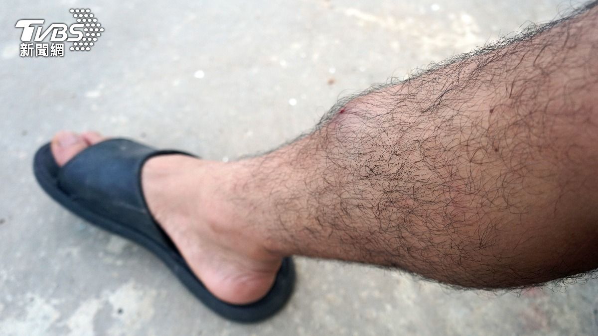 男生腳毛多=性慾強?泌尿醫證實了:機率比較高